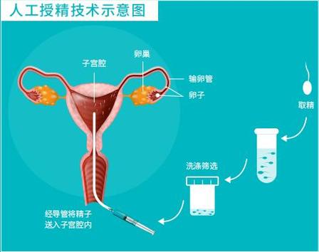 2024试管代怀合法-2024年试管代怀合法：新生命的希望