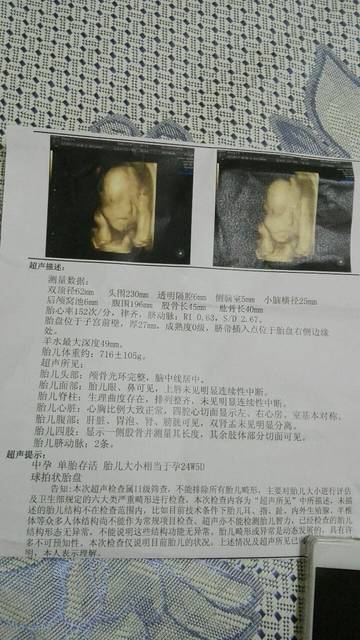 包生男孩是真的吗(包生男孩是真的吗?一起来探讨这个神秘现象)
